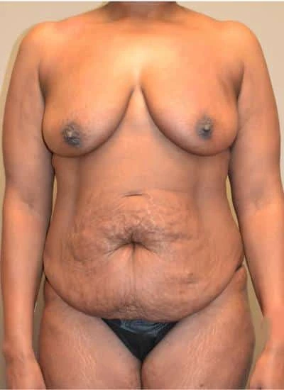 MOMMY-MAKEOVER-C12-B1