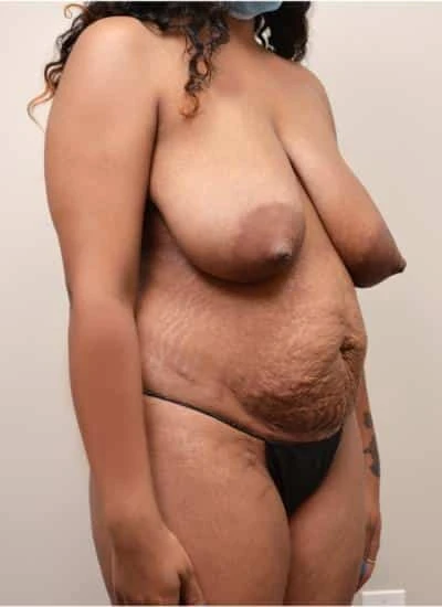 MOMMY-MAKEOVER-C6-B2