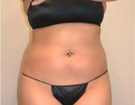 SMART-LIPO-C19-B1