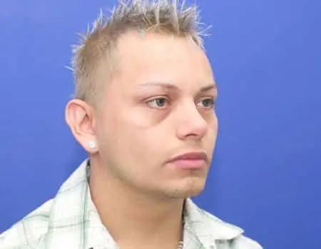 Rhinoplasty Before & After Case 5151