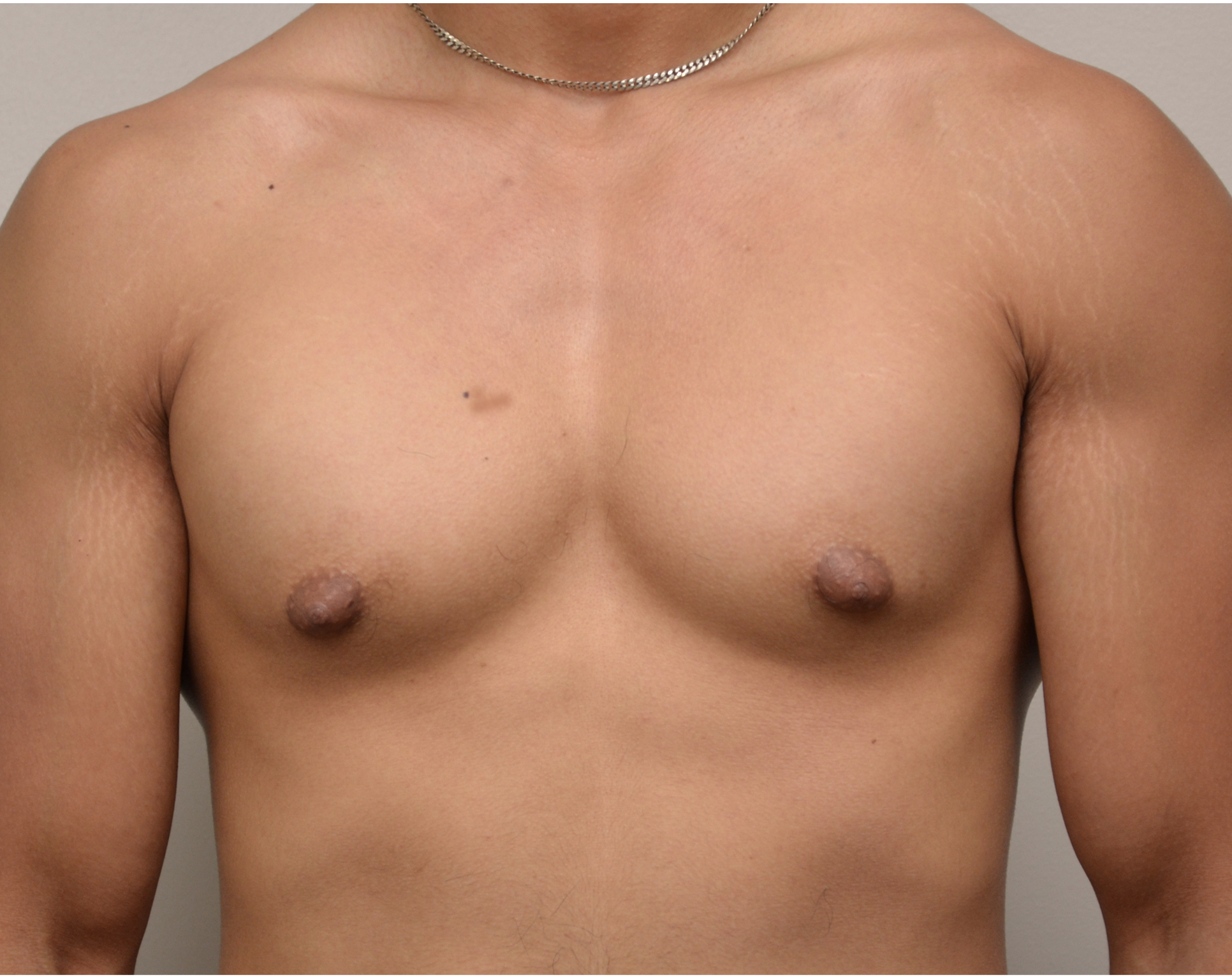 Gyno 19