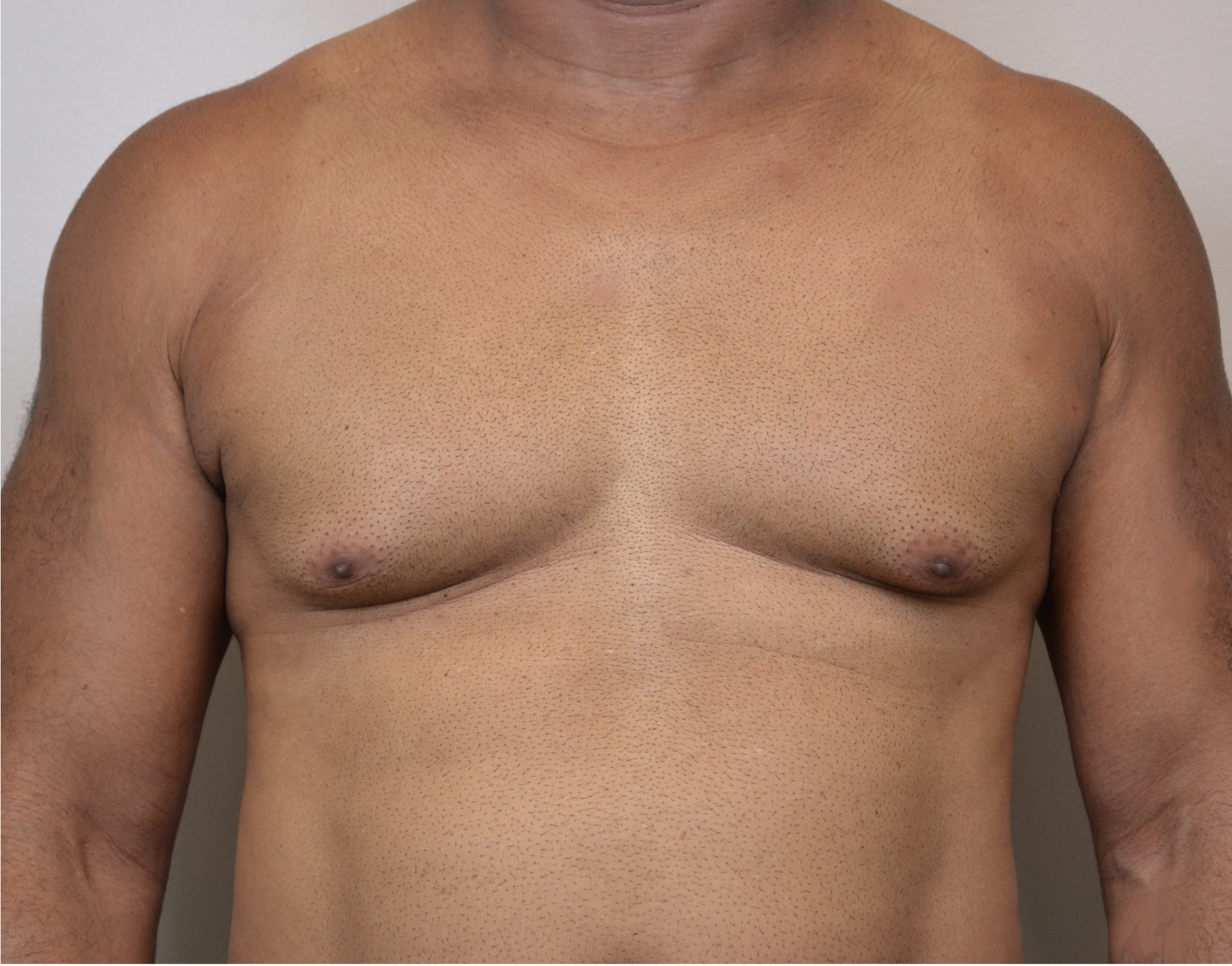 Gyno 31