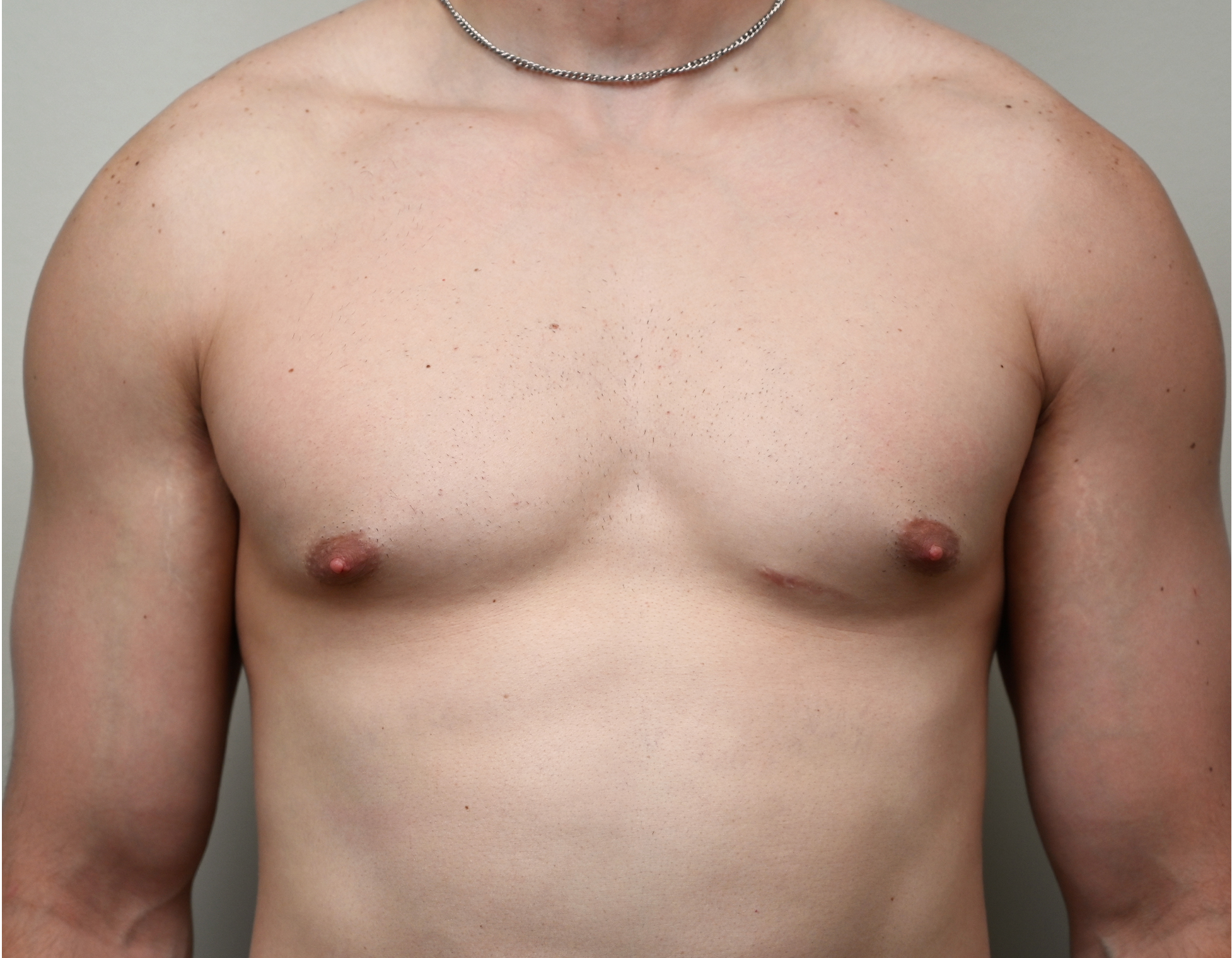 Gyno 49