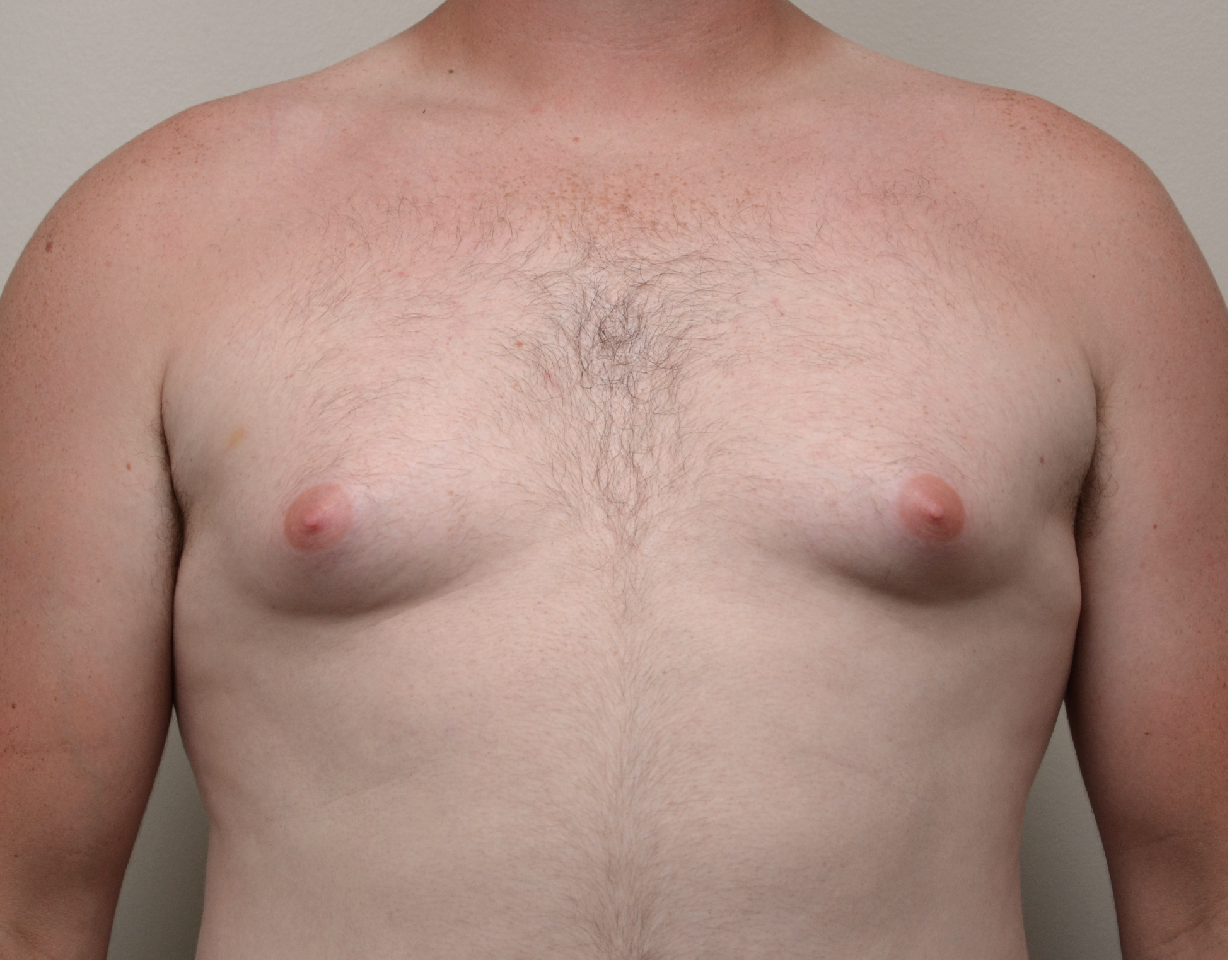 Gyno 67
