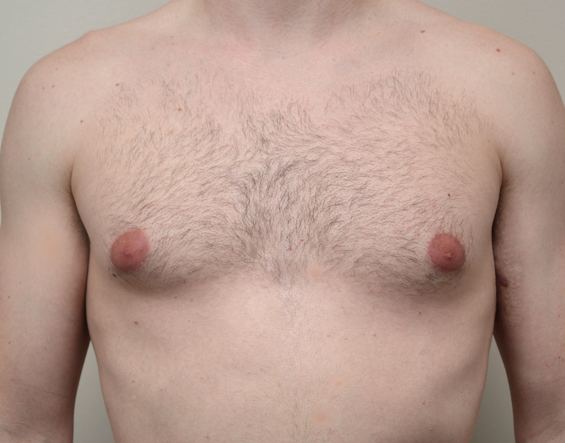 Gyno 7