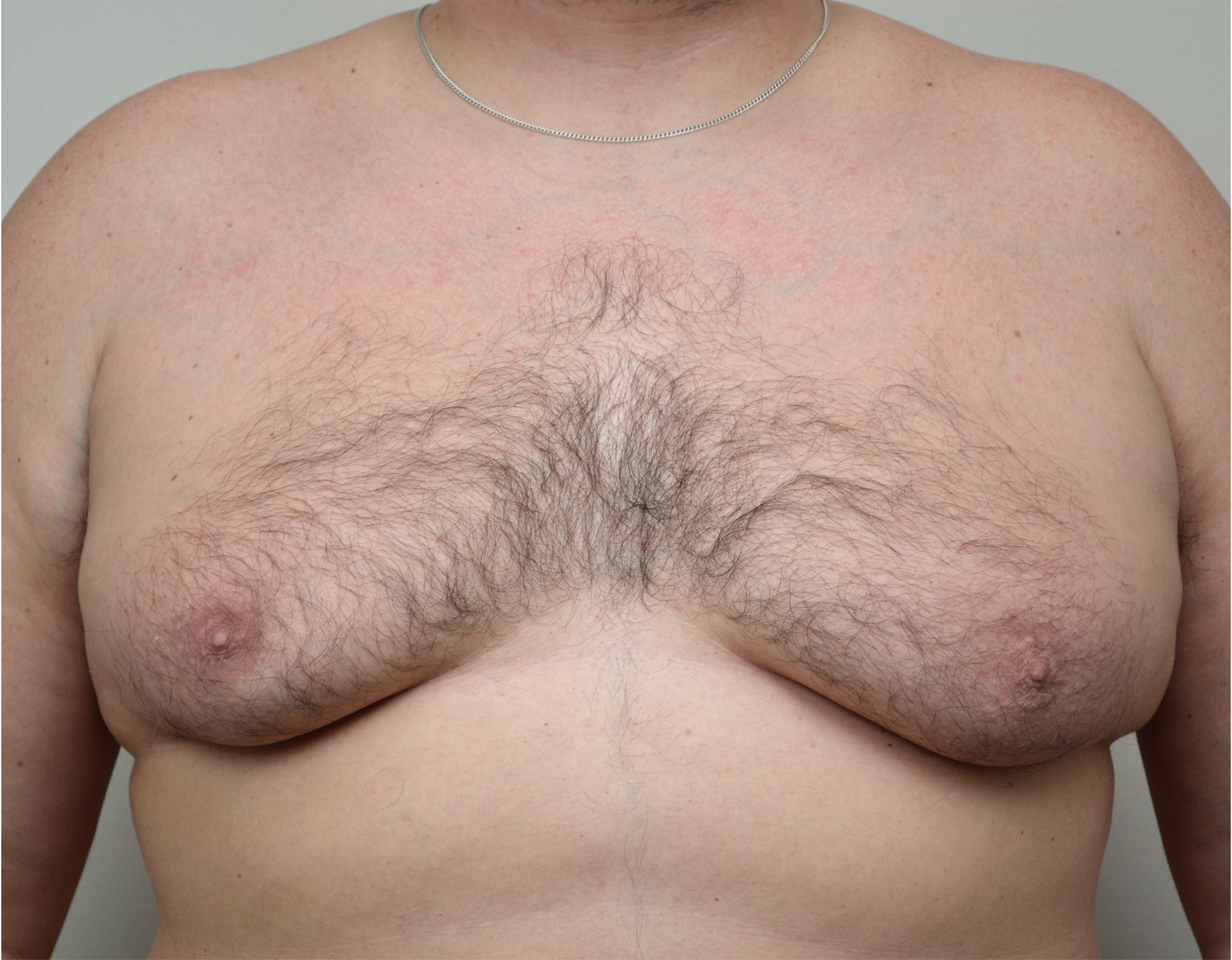 Gyno w_ng 7