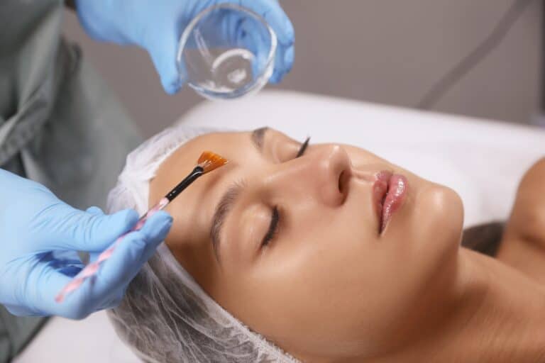 The Importance of Proper Aftercare Following Chemical Peels