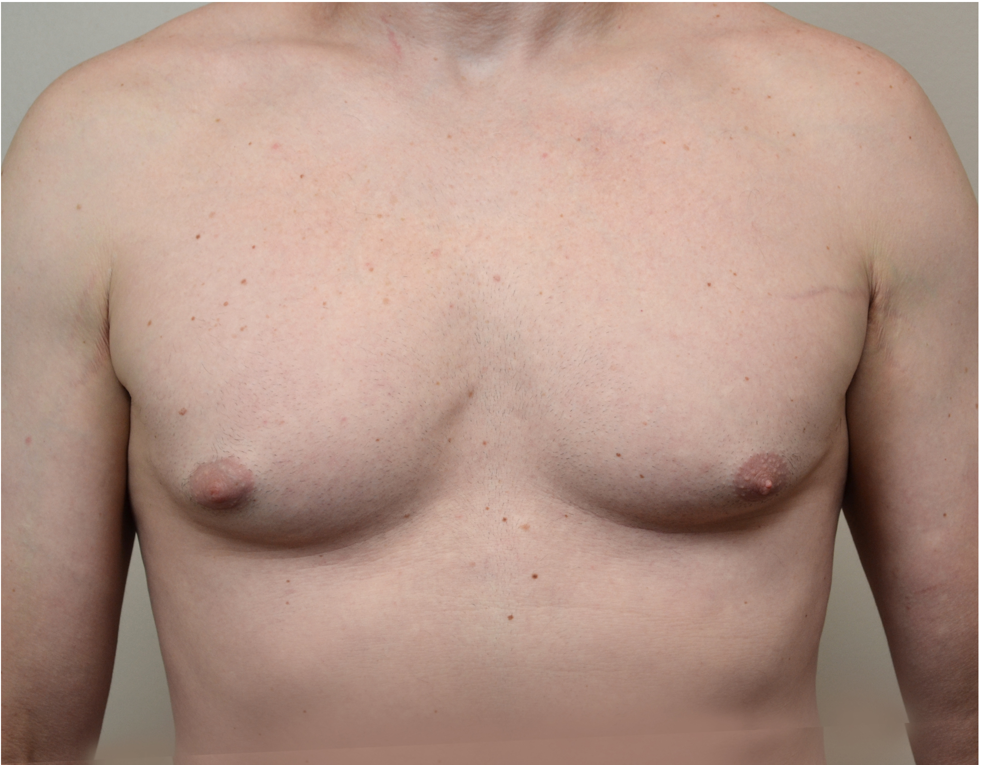 16 Gyno b1