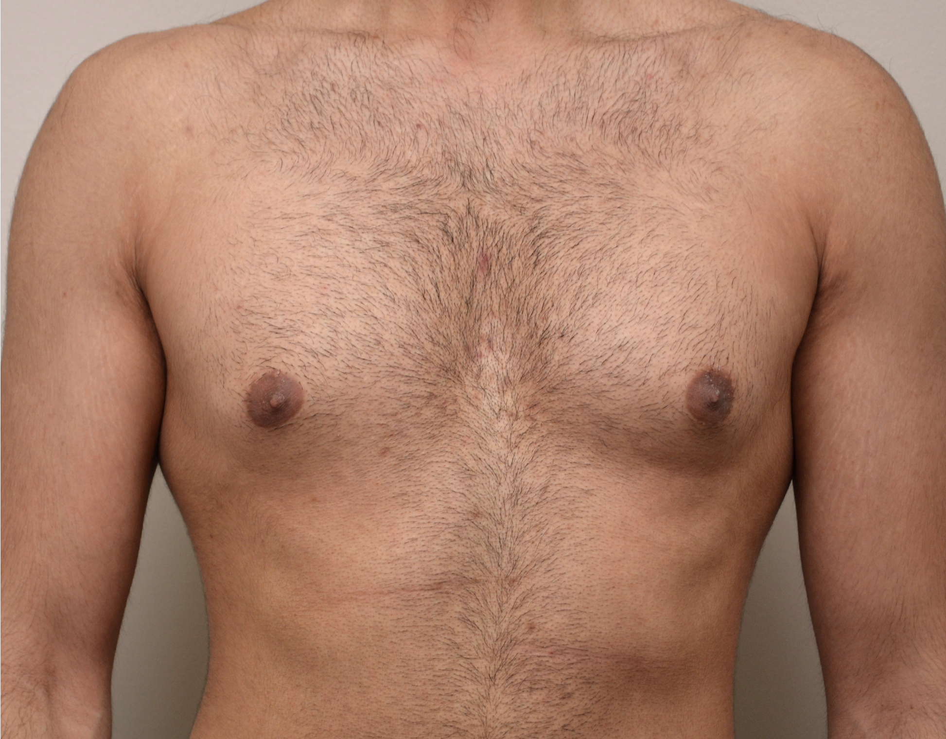 21 Gyno b1