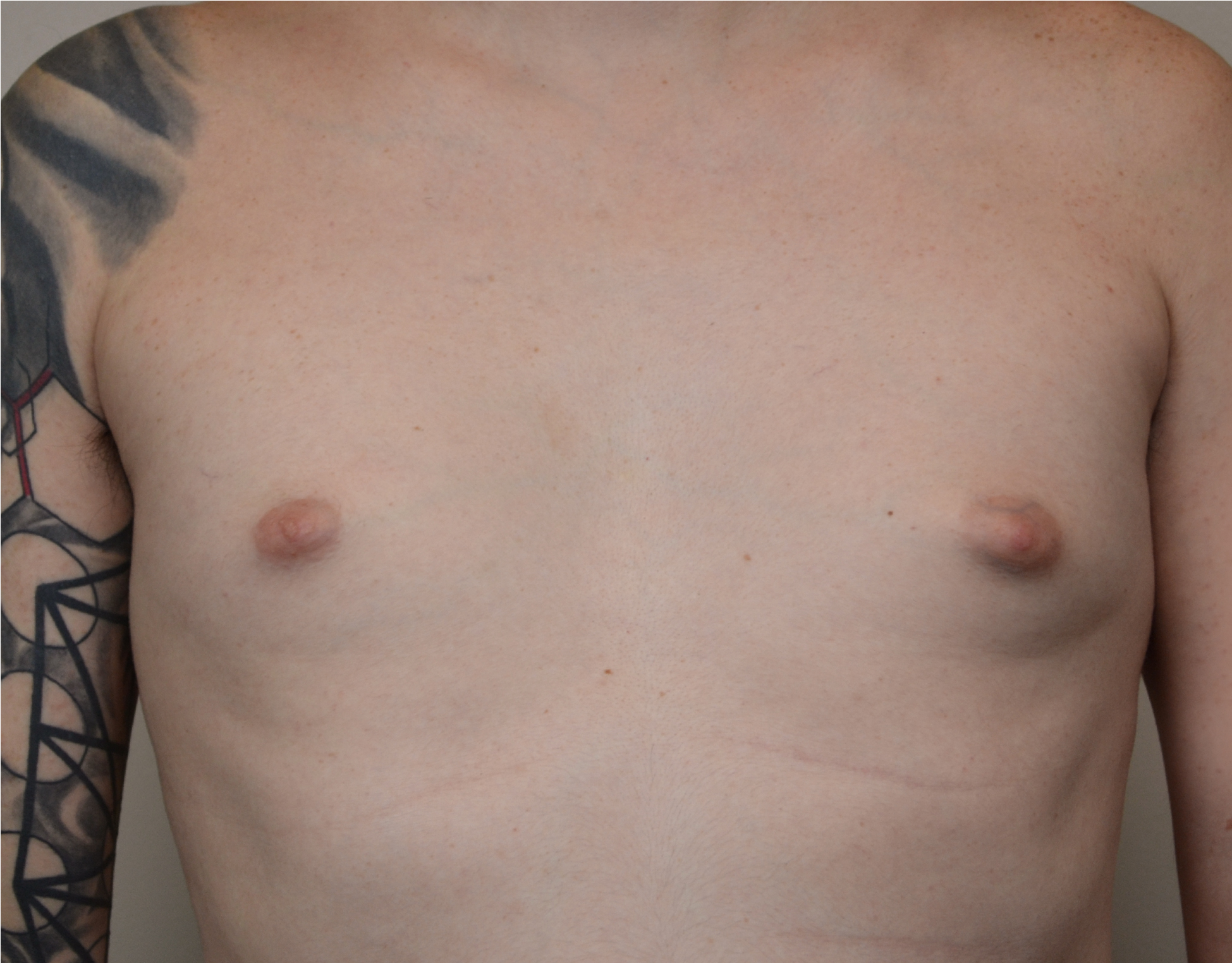 27 Gyno b1