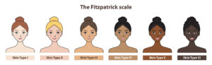 fitzpatrick scale